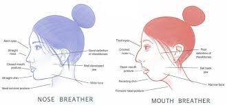 Mouth Breather Image